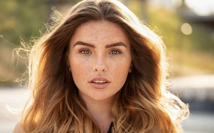 ericaandersonmd_botox